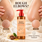 🌿✨ Van droge plekken naar zijdezachte huid – deze lotion met shea butter en jojoba-olie geeft intensieve hydratatie en trekt razendsnel in. 50% KORTING!
